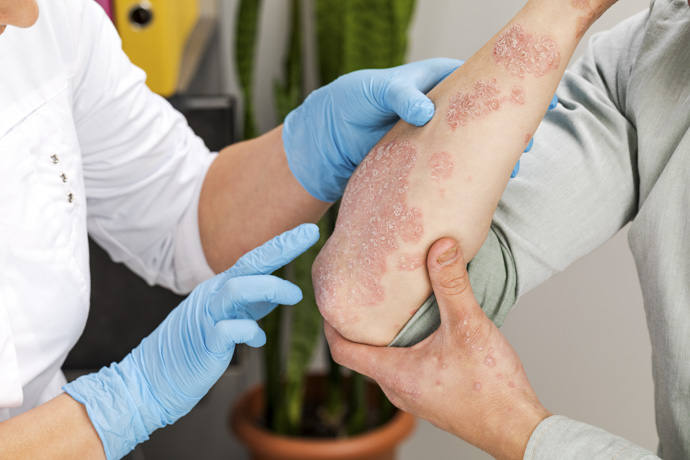 Dermatólogo revisa piel de paciente