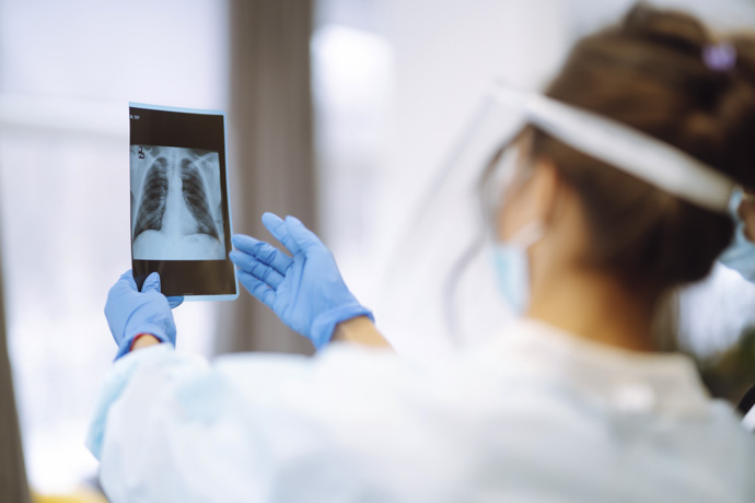 Médico explica manchas en los pulmones