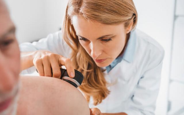 Doctora examinando un cáncer de piel de un paciente.